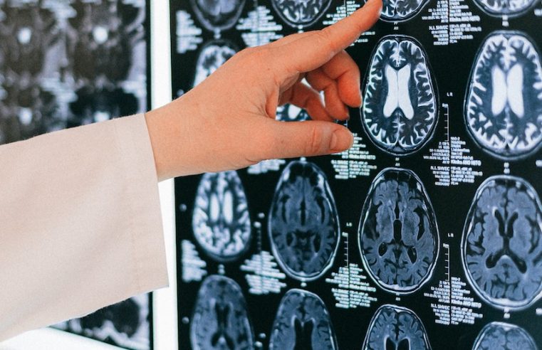 A new device inside the brain helps a tetraplegic man speak again